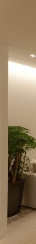 남성 여유증 수술 후 발생할 수 있는 부작용 알려드립니다. (혈종) 사진 7