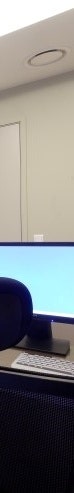 남자여유증수술 후 모양이 어색하게 느껴진다면 참고하세요 사진 12