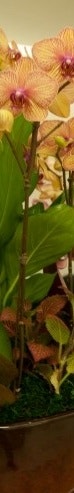 부유방 수술후? 솔직하게 말씀드리겠습니다. 사진 6
