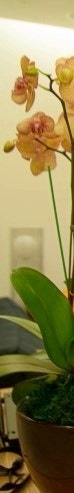 부유방수술후기에 '이것'이 자꾸 등장하는 이유 사진 4
