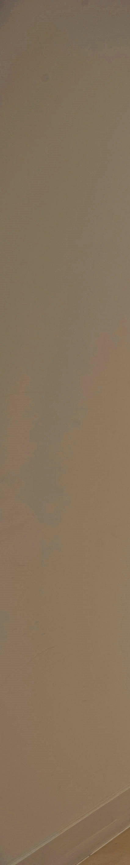 여유증수술통증이 걱정된다면 '이 글'을 참고하세요 사진 4